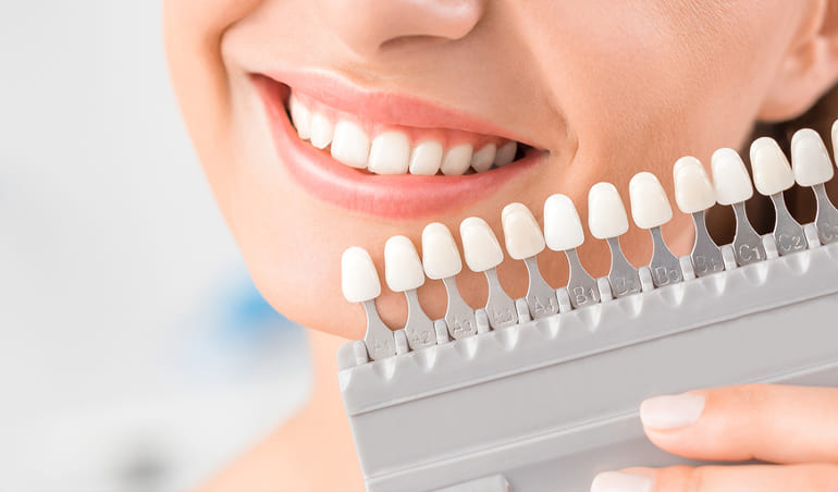 Blanqueamiento Dental